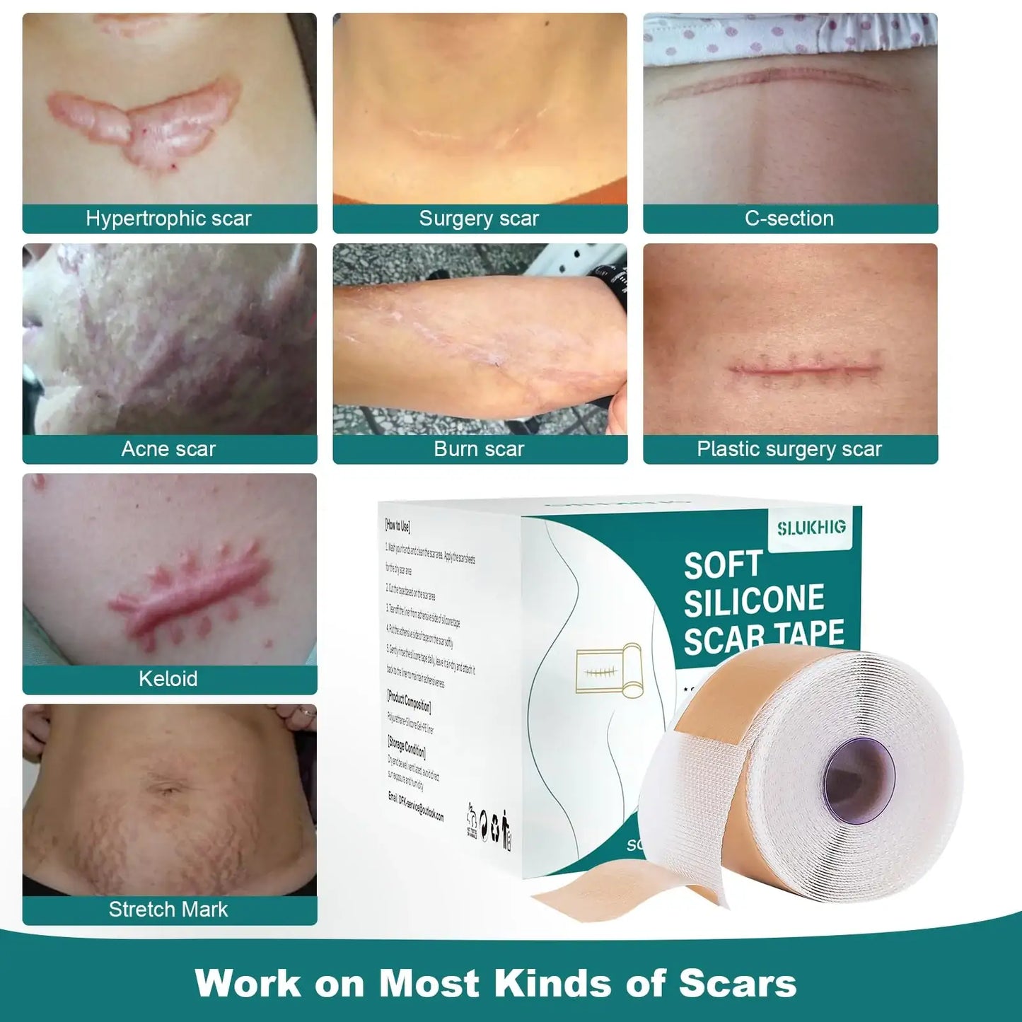 Silicone Scar Sheets Roll for Keloid and Post-Surgical Scars - imprüv