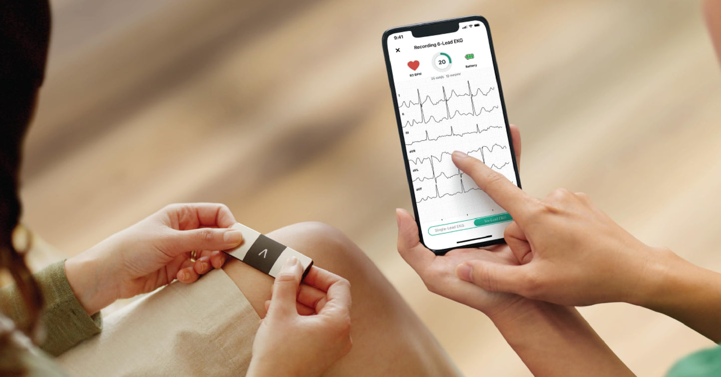 Personal EKG Monitor for Arrhythmia Detection and Heart Tracking