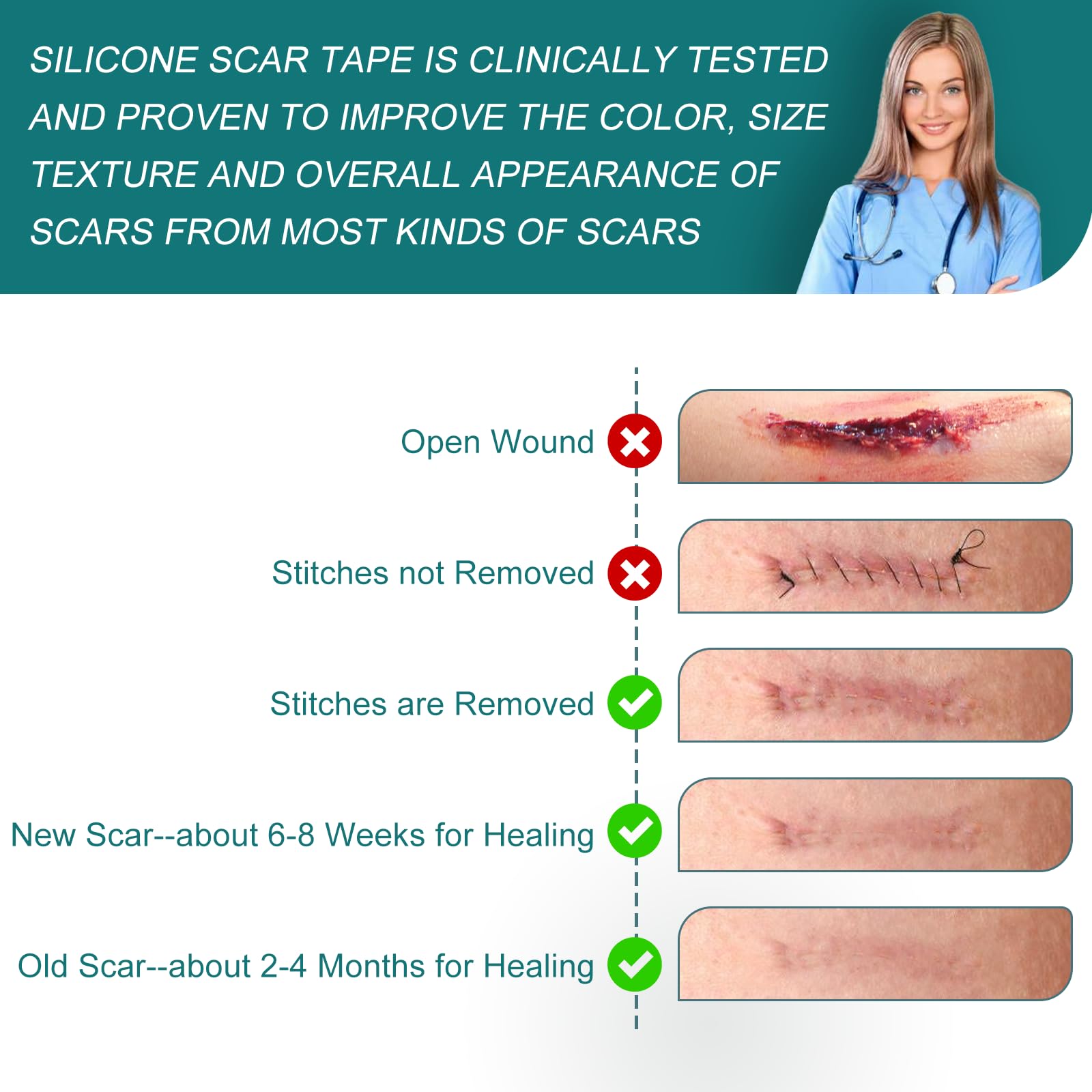 Silicone Scar Sheets Roll for Keloid and Post-Surgical Scars - imprüv 