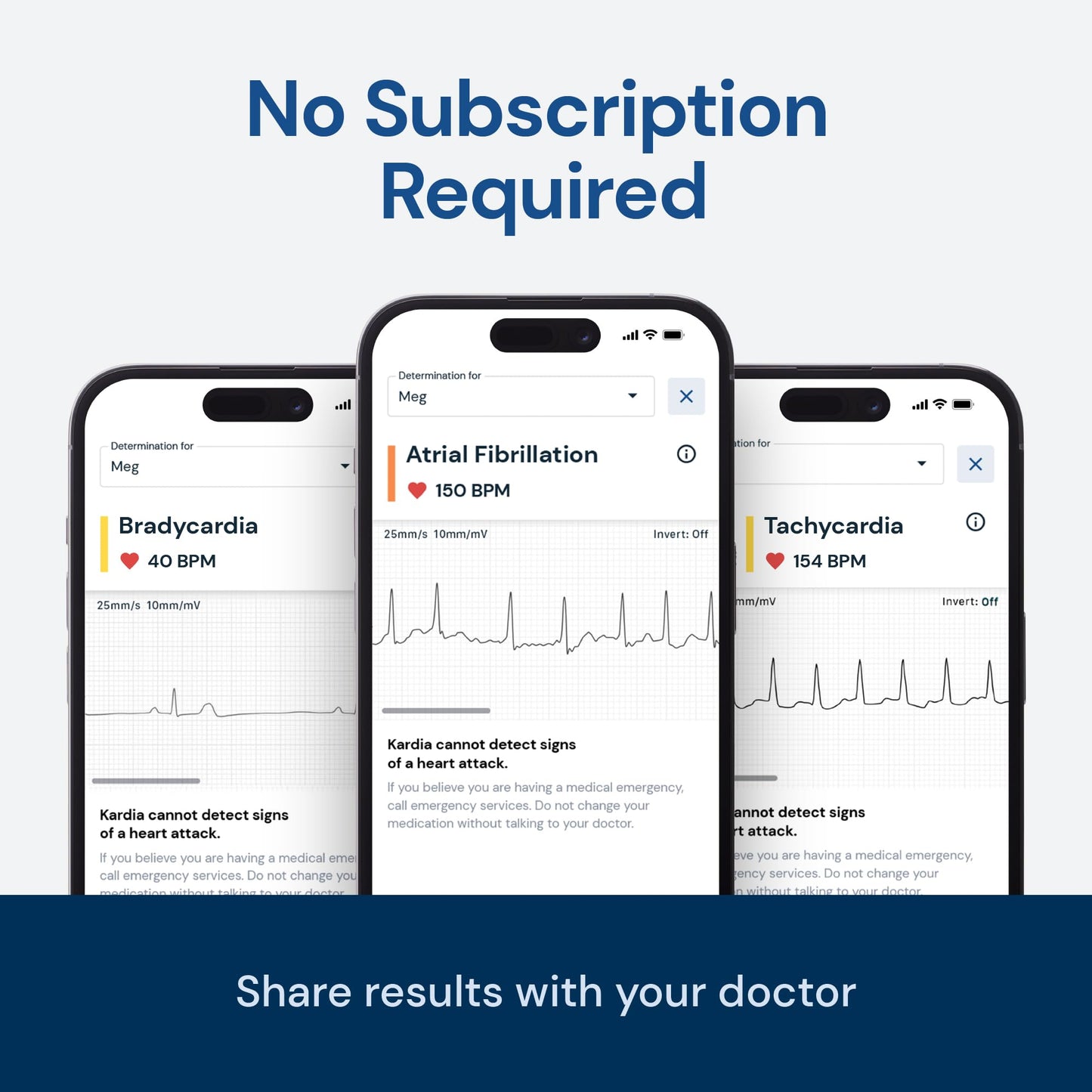 Personal EKG Monitor for Arrhythmia Detection, FDA-Cleared
