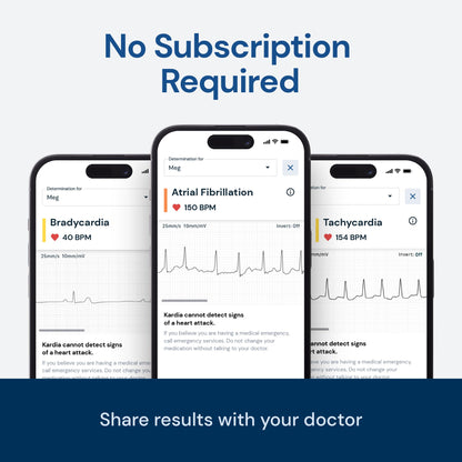 Personal EKG Monitor for Arrhythmia Detection, FDA-Cleared
