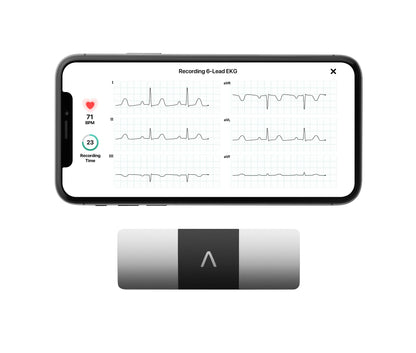 Personal EKG Monitor for Arrhythmia Detection and Heart Tracking