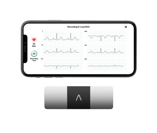Personal EKG Monitor for Arrhythmia Detection and Heart Tracking