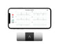 Personal EKG Monitor for Arrhythmia Detection and Heart Tracking