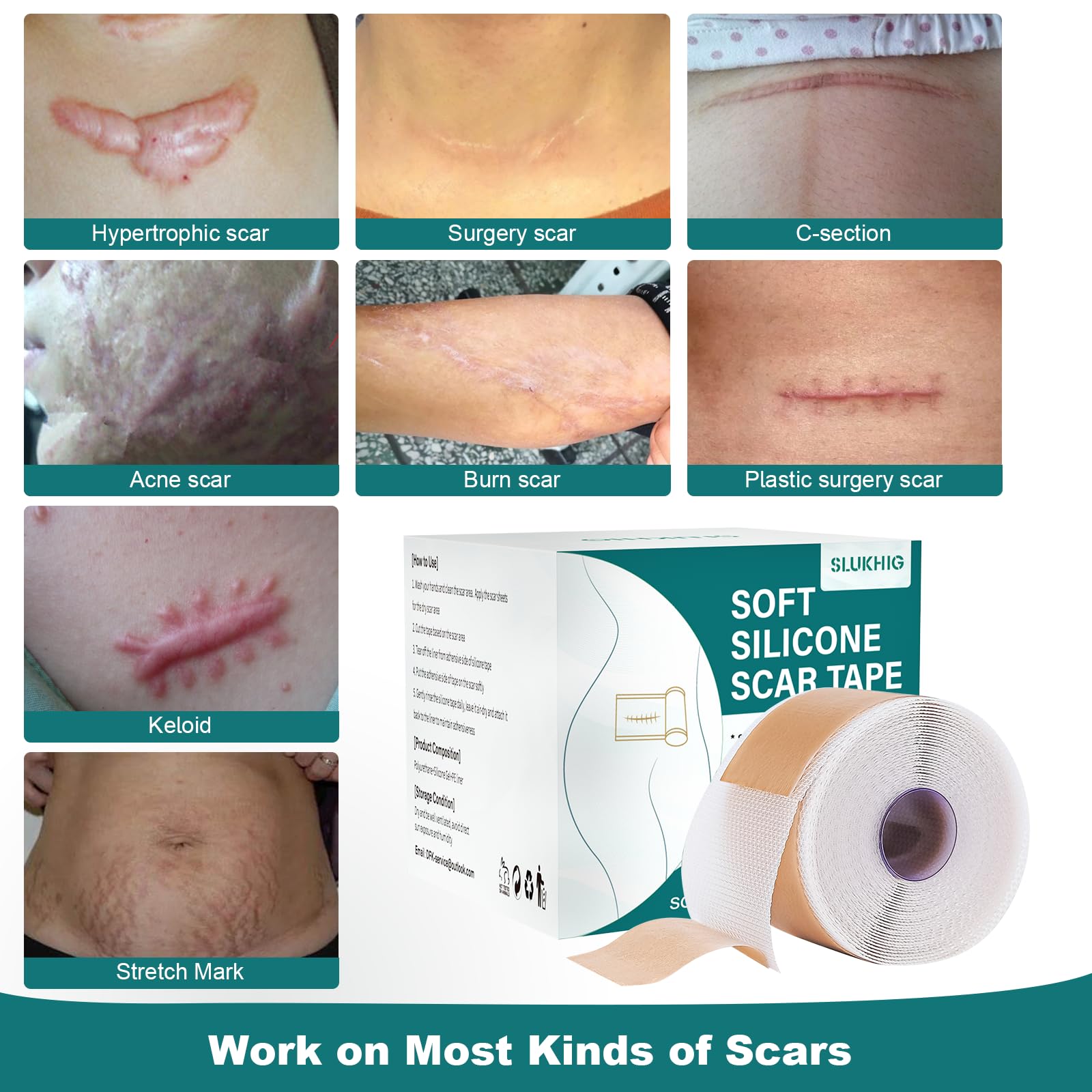 Silicone Scar Sheets Roll for Keloid and Post-Surgical Scars - imprüv 