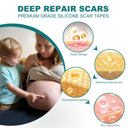 Silicone Scar Sheets Roll for Keloid and Post-Surgical Scars - imprüv 