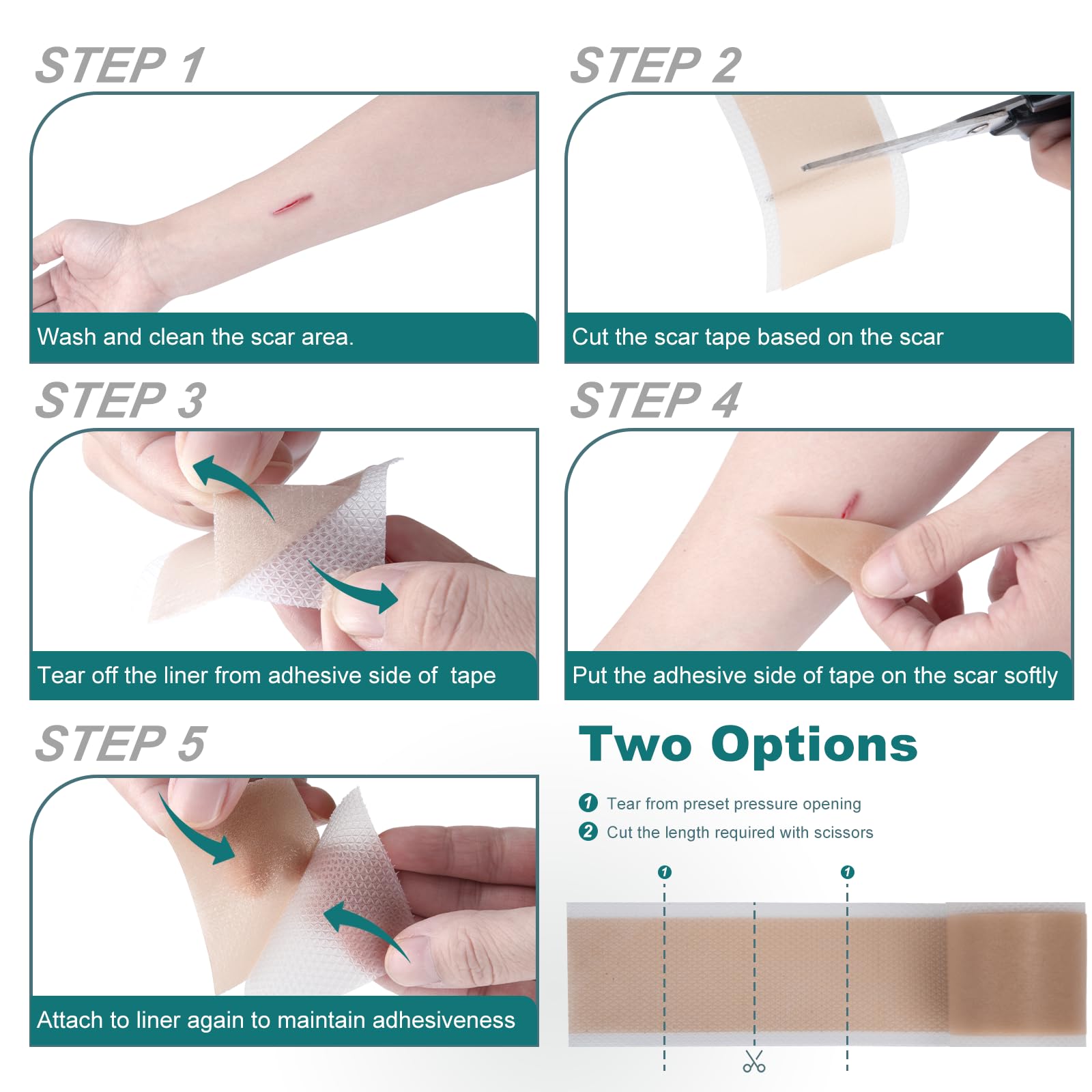 Silicone Scar Sheets Roll for Keloid and Post-Surgical Scars - imprüv 
