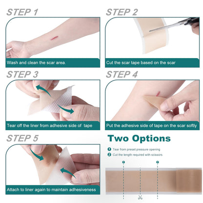 Silicone Scar Sheets Roll for Keloid and Post-Surgical Scars - imprüv 