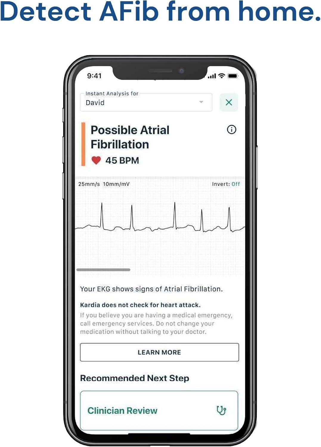 Personal EKG Biometric Heart Monitor for Easy Heart Health Tracking with 30-Second Results - imprüv  