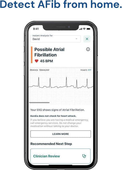 Personal EKG Biometric Heart Monitor for Easy Heart Health Tracking with 30-Second Results - imprüv  