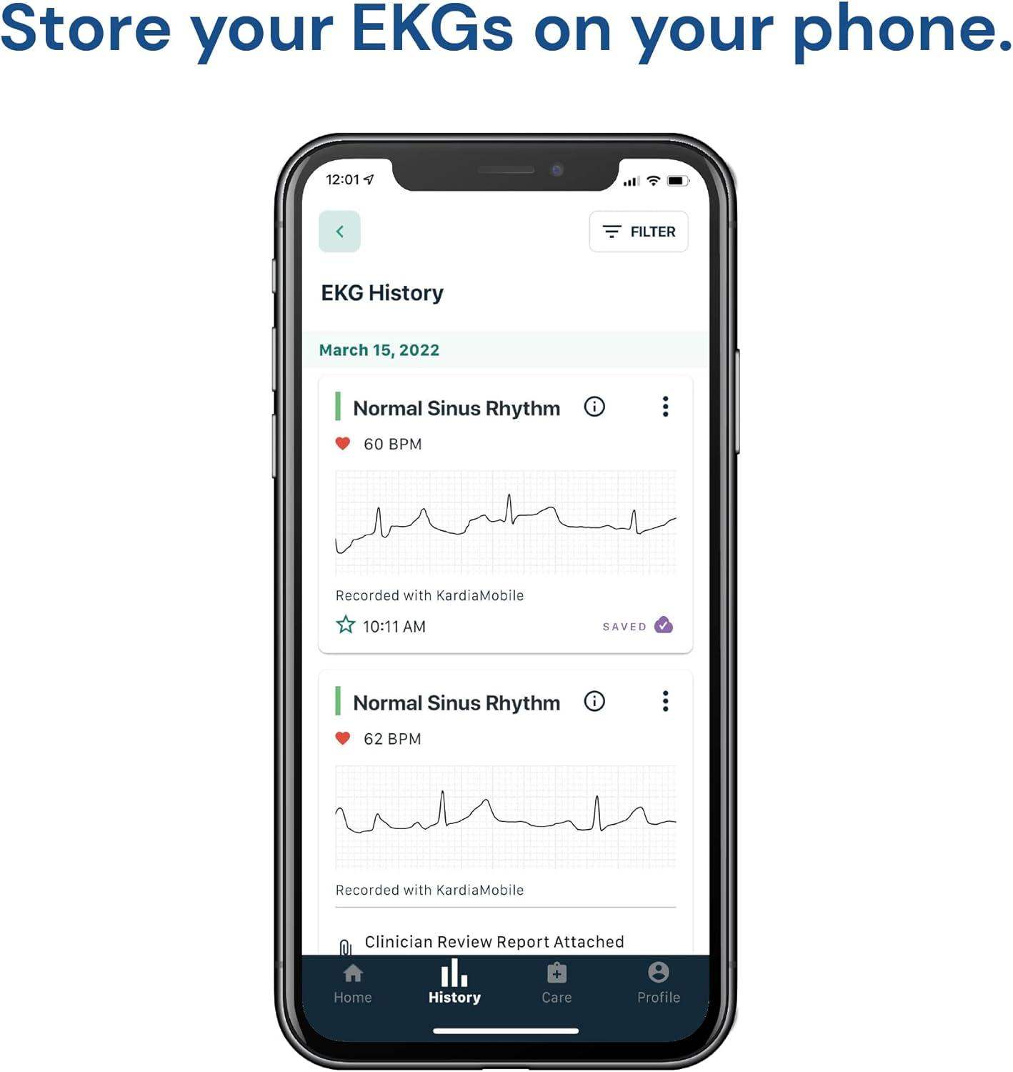 Personal EKG Biometric Heart Monitor for Easy Heart Health Tracking with 30-Second Results - imprüv  