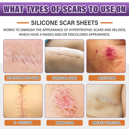 Silicone Scar Sheets Roll for Keloids and Post-Surgical Scars Supports Smoother Skin Appearance and Scar Texture Improvement - imprüv  