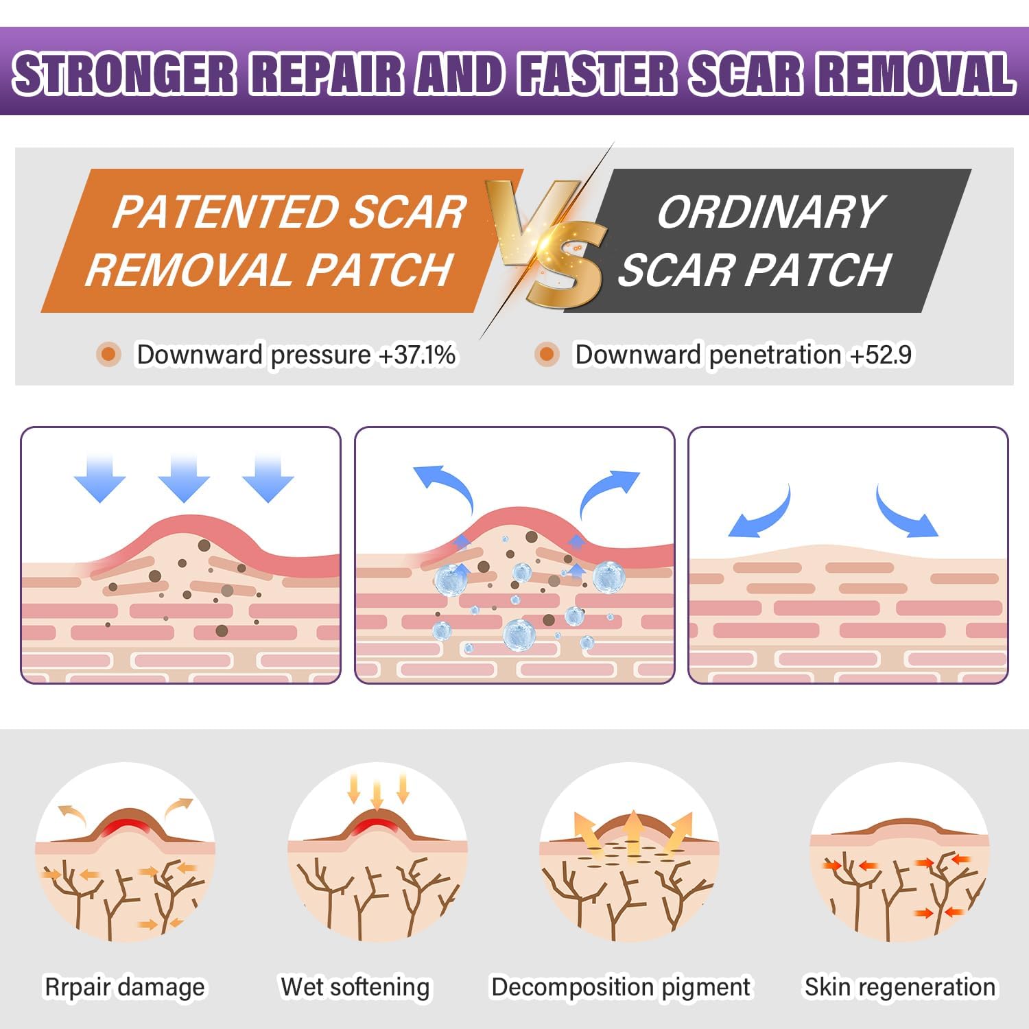 Silicone Scar Sheets Roll for Keloids and Post-Surgical Scars Supports Smoother Skin Appearance and Scar Texture Improvement - imprüv  