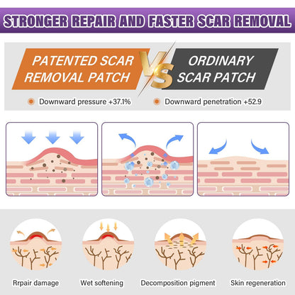 Silicone Scar Sheets Roll for Keloids and Post-Surgical Scars Supports Smoother Skin Appearance and Scar Texture Improvement - imprüv  