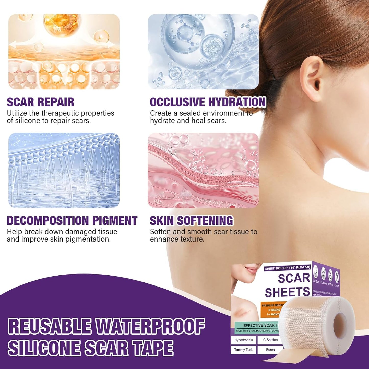 Silicone Scar Sheets Roll for Keloids and Post-Surgical Scars Supports Smoother Skin Appearance and Scar Texture Improvement - imprüv  