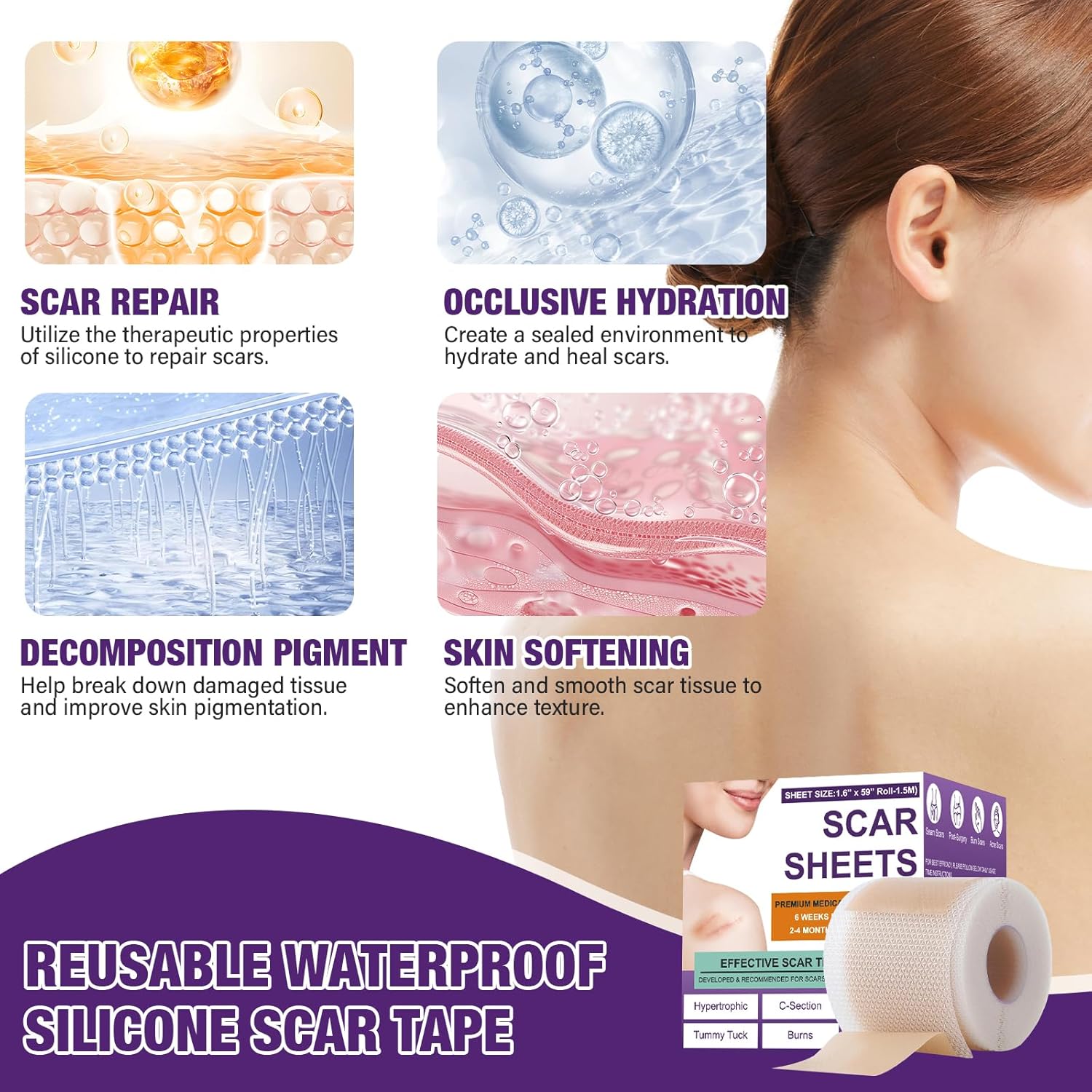 Silicone Scar Sheets Roll for Keloids and Post-Surgical Scars Supports Smoother Skin Appearance and Scar Texture Improvement - imprüv  