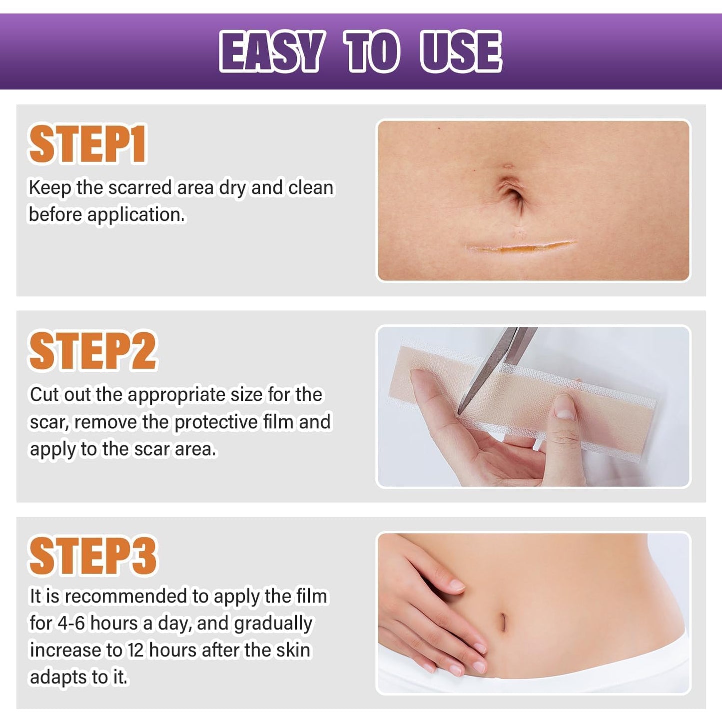 Silicone Scar Sheets Roll for Keloids and Post-Surgical Scars Supports Smoother Skin Appearance and Scar Texture Improvement - imprüv  