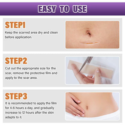 Silicone Scar Sheets Roll for Keloids and Post-Surgical Scars Supports Smoother Skin Appearance and Scar Texture Improvement - imprüv  