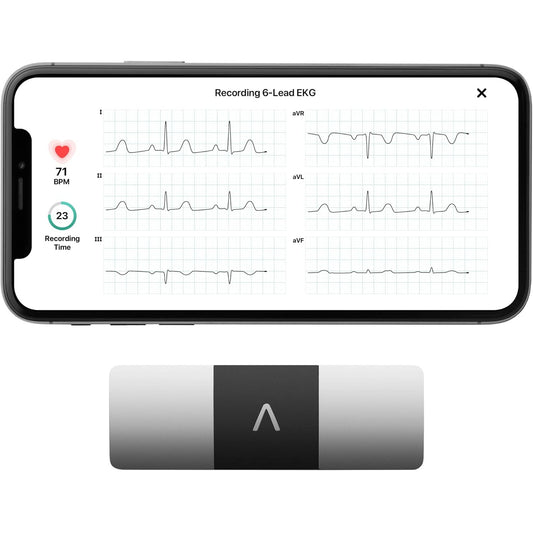 Personal EKG Monitor for Arrhythmia Detection and Heart Tracking - imprüv 